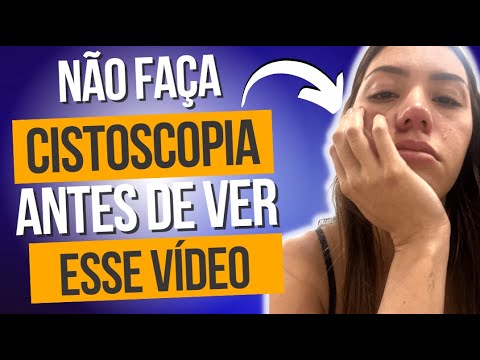 Vídeo: Cistoscopia dói?