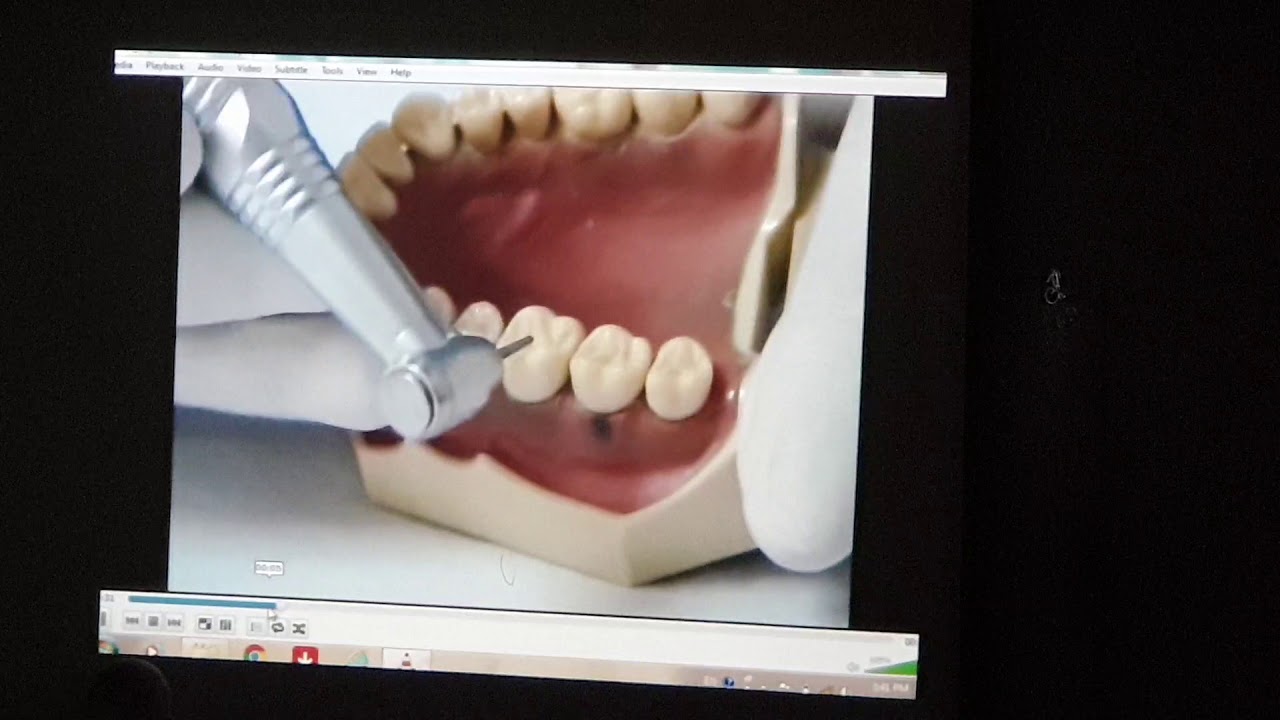TP fixée - préparation du CCM (PART 1/4)