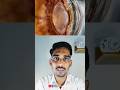 Cataract Sirf Budhape Ki Bimari Nahi! Young Adults Mein Bhi Kyu Badh Raha Hai? | #cataract