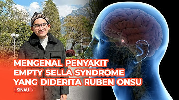 Mengenal Empty Sella Syndrome yang Diderita Ruben Onsu, Apa Penyebabnya?