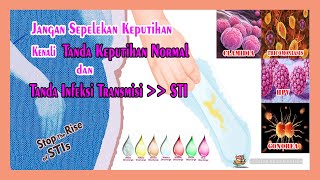 Mengenal Jenis Keputihan Normal Dan Tidak Normal Pada Wanita