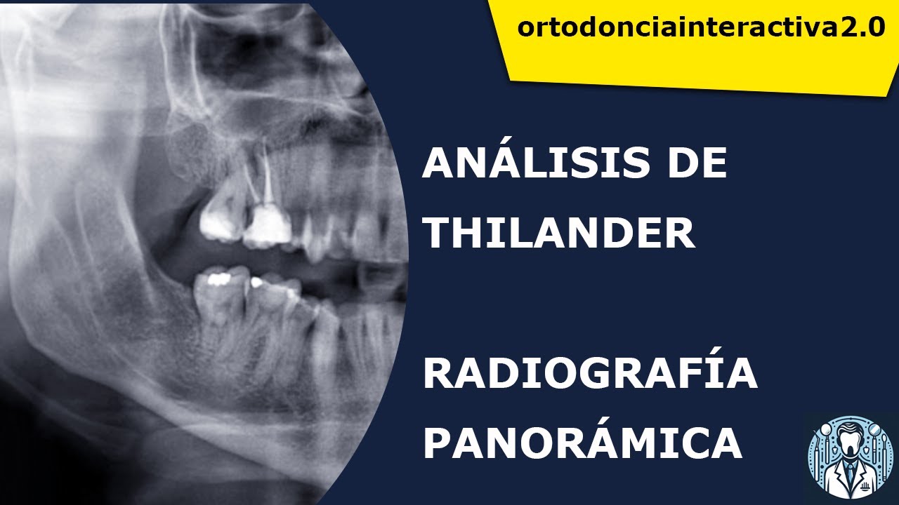 ANALÍSIS DE THILANDER EN ORTODONCIA