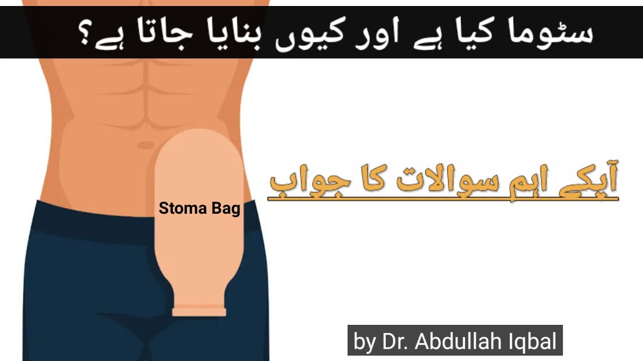 Stoma Ileostomy vs Colostomy Stoma Bag Care at home Examine
