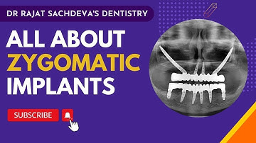 Zygomatic Implants training course | Zygomatic implants training | Zygomatic Implants courses delhi