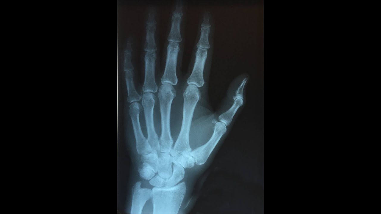 Second Time Around Solo TAB LINK