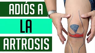 ¿Tienes artrosis en la rodilla? 4 ejercicios para mejorar ya