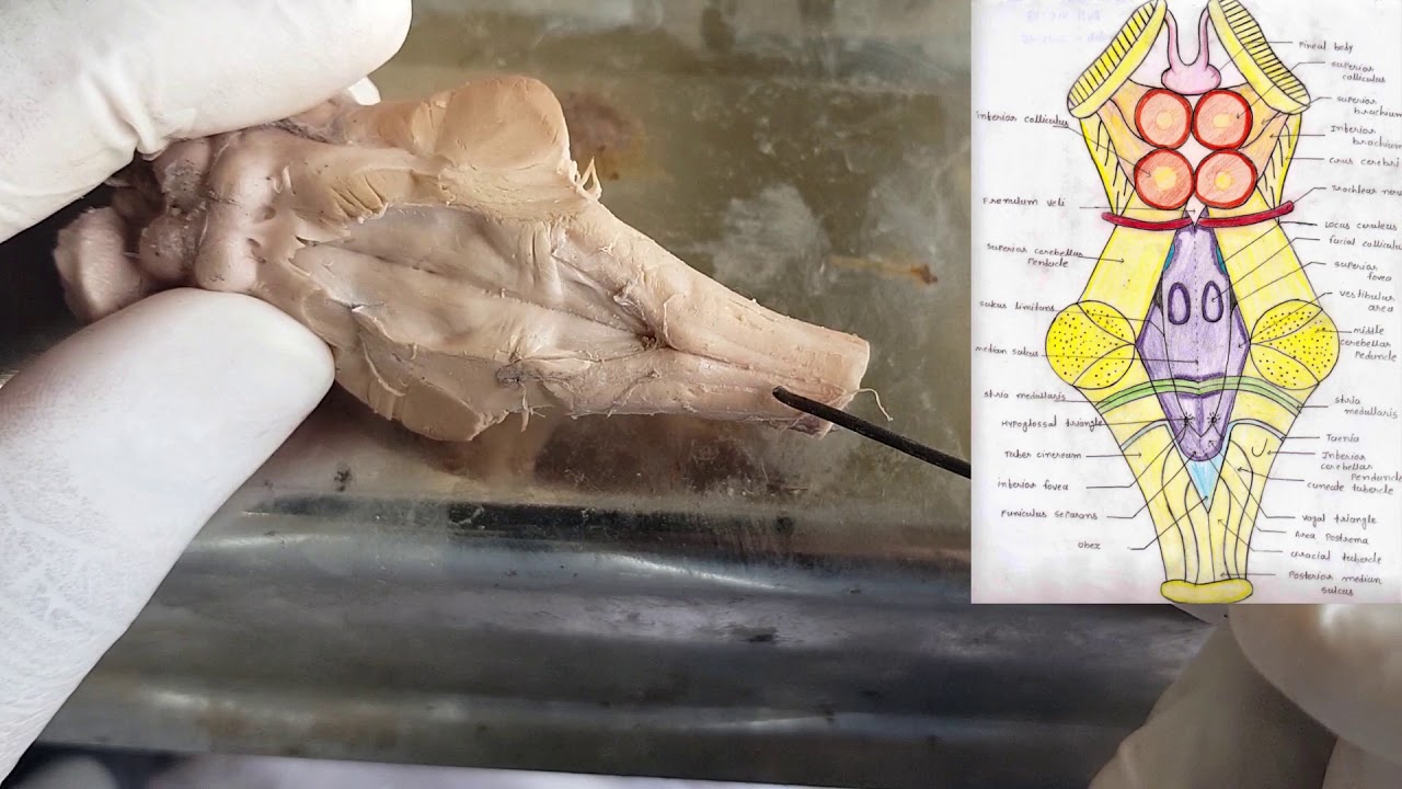 Brainstem - external features ( Gross Anatomy) Parts | Relations | Applied Anatomy