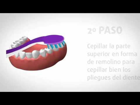 Vídeo: Obre Wide! Higiene Dental Per A Cavalls
