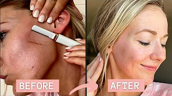 I SHAVED MY FACE AND THIS HAPPENED | DO's &  DONT's