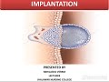 Implantation process (Animation)