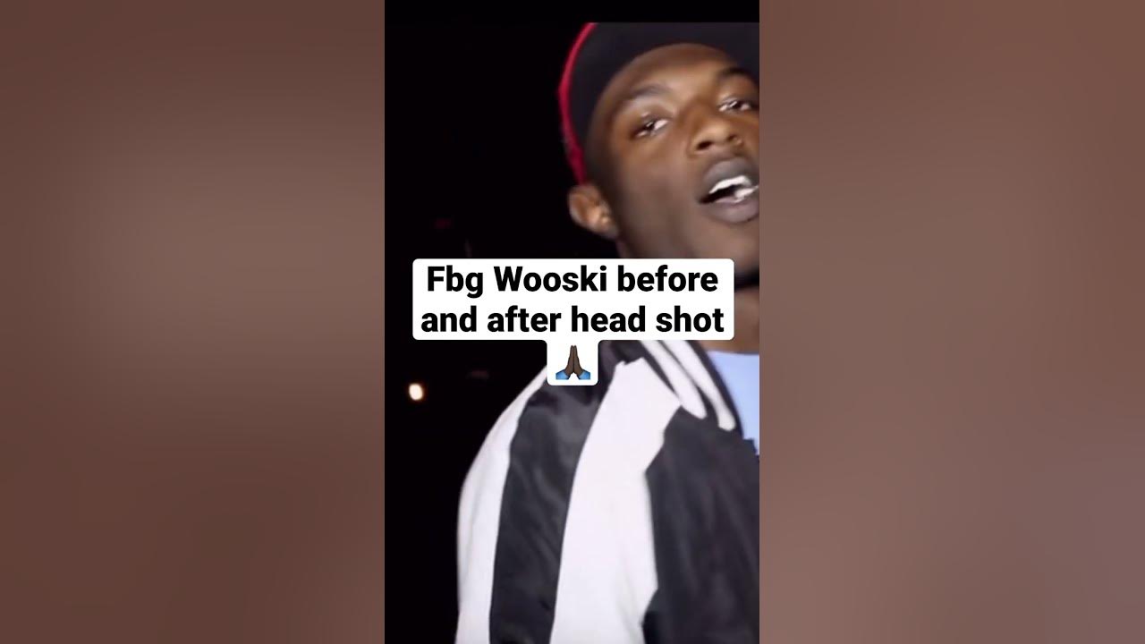 Wooski Got Shot Now He Taking Medicine Fbg Wooski before and after the head shot. Continued and full recovery🙏