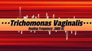 Trichomonas Vaginalis, Healing Frequency: 3600 Hz