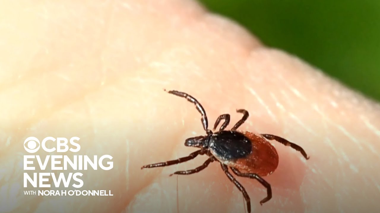 Alpha-gal syndrome: Meat allergy linked to tick bites rising, CDC says