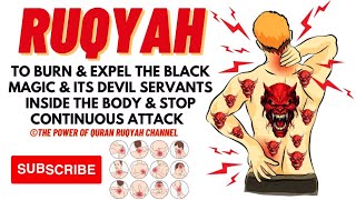 Ultimate Ruqyah to Burn&Expel the Black Magic&its Devil Servants inside Body&Stop Continuous Attack