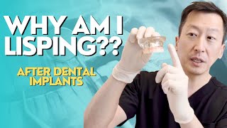 How Multi Unit Abutments Affect Speech and Bulk on All on 4 Dental Implants