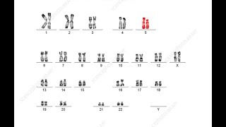 Unraveling Cri du Chat Syndrome: A Dive into Recent Research