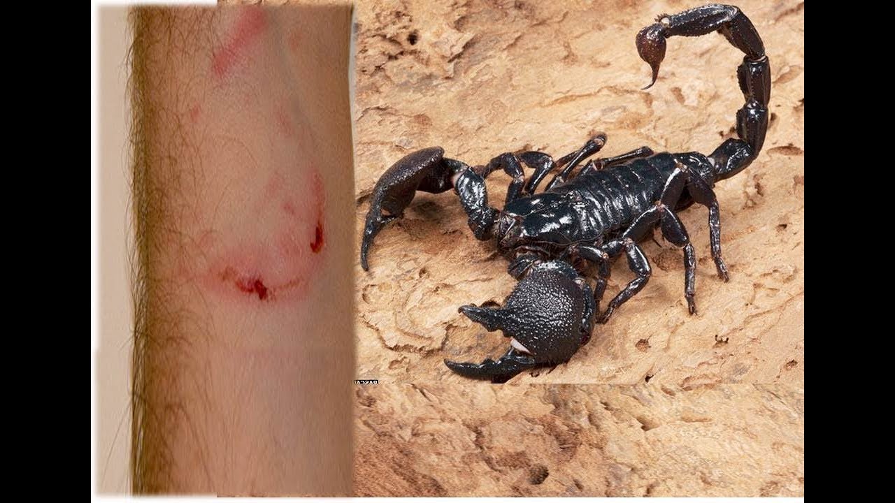 Укус скорпиона. Последствия для человека