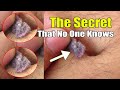 What's Inside Your Belly Button! The Secret that no one knows about belly botton fluff forms dangero