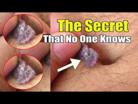 What&#39;s Inside Your Belly Button! The Secret that no one knows about belly botton fluff forms dangero