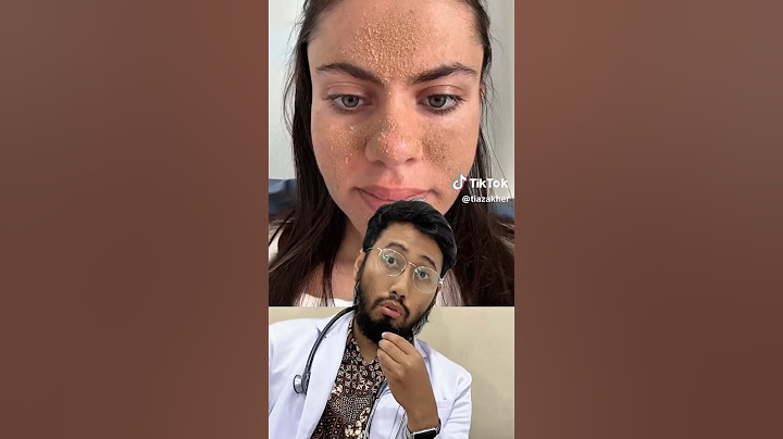 😱 Wanita ini GAK CUCI MUKA BERBULAN-BULAN ⁉️ #faktaunik #faktakesehatan
