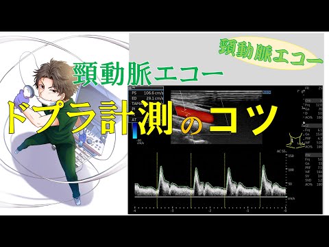 【頸動脈エコー】ドプラ計測のコツとポイント！