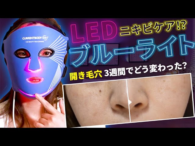おうちで本格ニキビケア！　【青色LEDライト 460nm波長 スキンケアライト】 Does blue LED improve acne and enlarged pores? 3-week review - YouTube