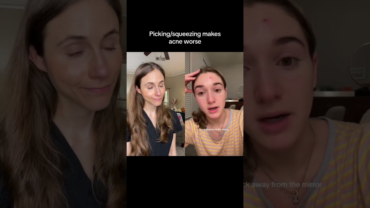 Popping Pimples Is Never A Good Idea Dermatologist