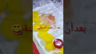 لاب روتين فحص الملاريا Malaria