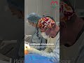 ✨ SMAS-лифтинг без наркоза