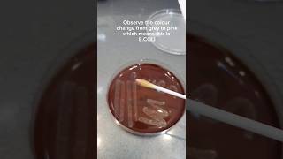 Indole test for E.coli identification.  #bacteria #ecoli #gramstaining #fyp #laboratory