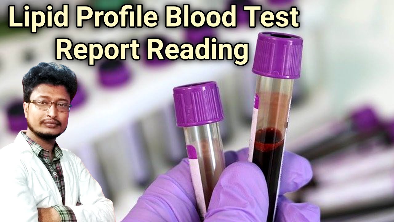 Lipid Profile Report Kaise Padhe How To Read Lipid Profile Test Lipid Profile Report Kaise Padhe How To Read Lipid Profile Test