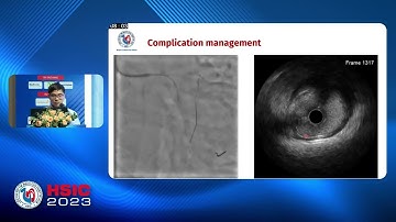 HSIC AWARDS 2023: DIỄN ĐÀN BIẾN CHỨNG VÀ CAN THIỆP TIM MẠCH PHỨC TẠP- PHIÊN TIẾNG VIỆT