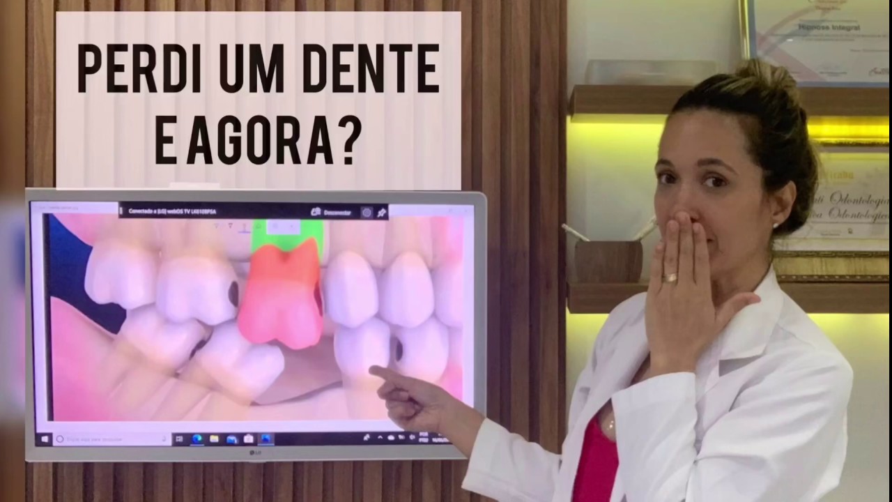 Fiz Restauração é Meu Dente Dói Quando Bebo água Gelada O que fazer quando se perde um dente - YouTube