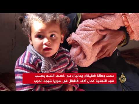 انتشار كبير لأمراض سوء التغذية بين أطفال ريف حمص