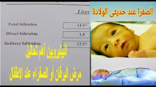 تعلم قراءة تحليل الصفراء Bilirubin واعرف اسباب الصفراء التكسيرية لحديثى الولادة