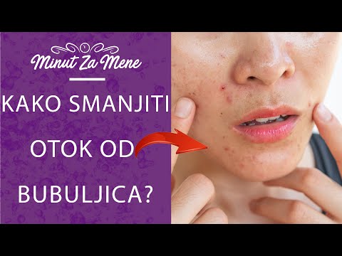 Video: Kako komunicirati sa svojim psom (sa slikama)