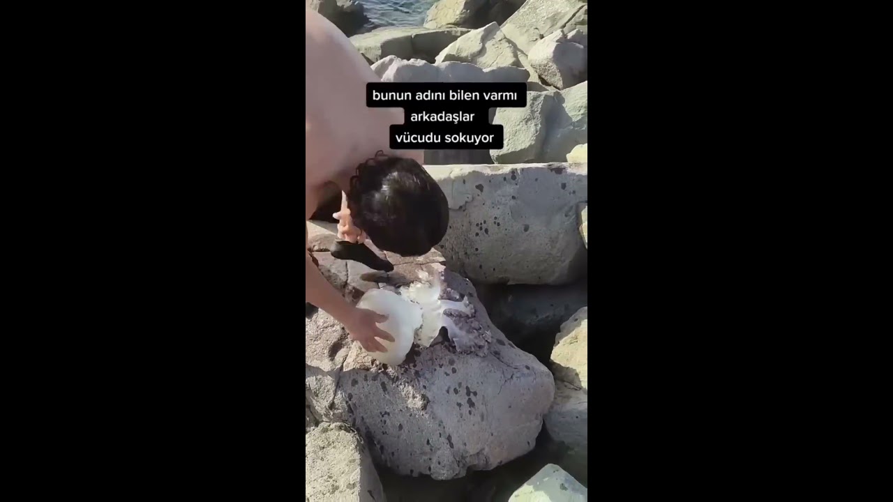 NEVER Pick Up A Jellyfish Shorts