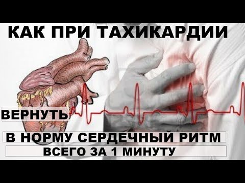 КАК ПРИ ТАХИКАРДИИ ВЕРНУТЬ В НОРМУ СЕРДЕЧНЫЙ РИТМ ВСЕГО ЗА! МИНУТУ