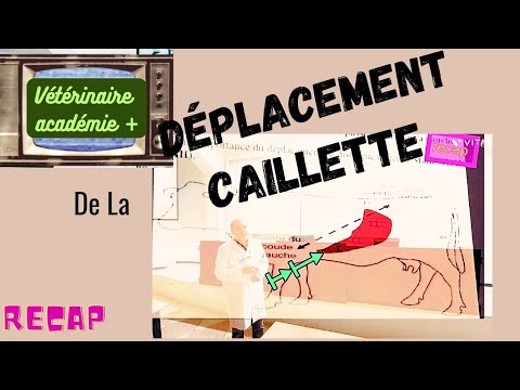 Vidéo: Qu'est-ce qu'une caillette déplacée ?