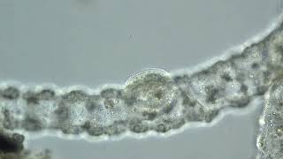 Hydra With Lice (Trichodina_Pediculus)
