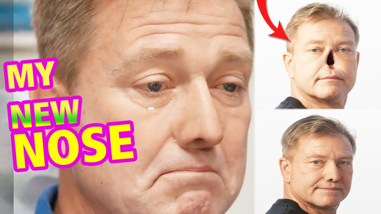 My New Nose Body Parts TLC trailer YouTube