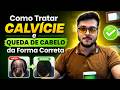 Como Tratar Calvície e Queda de Cabelo da Forma Correta