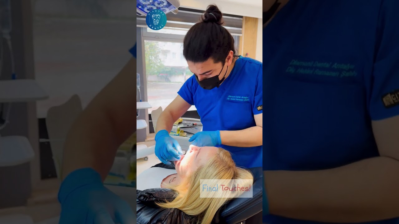 Zygomatic Dental Implants | Diamond Dental Antalya