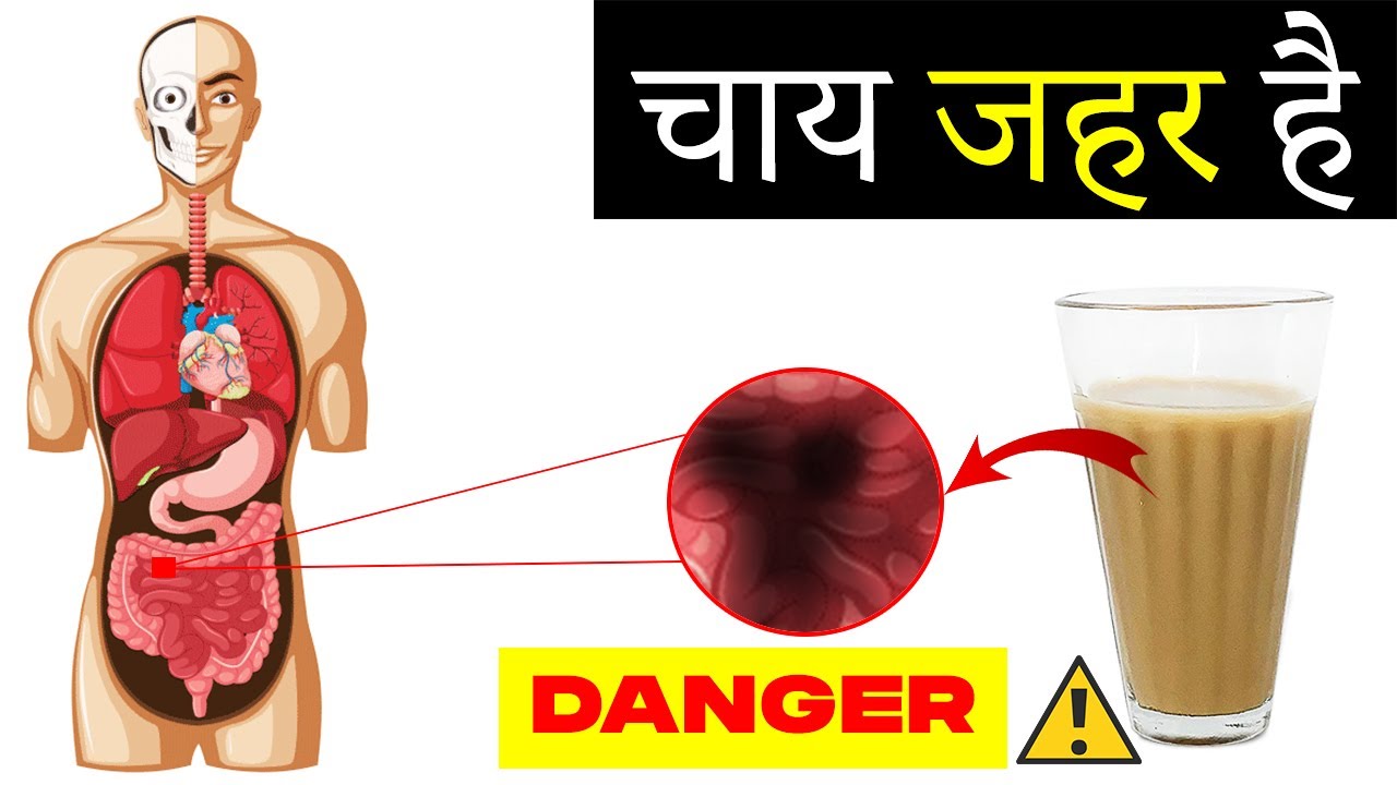 Tea Side Effects | Chai ke Nuksan | चाय पीने के 8 नुकसान | Health Tips | Dr SS Yadav |