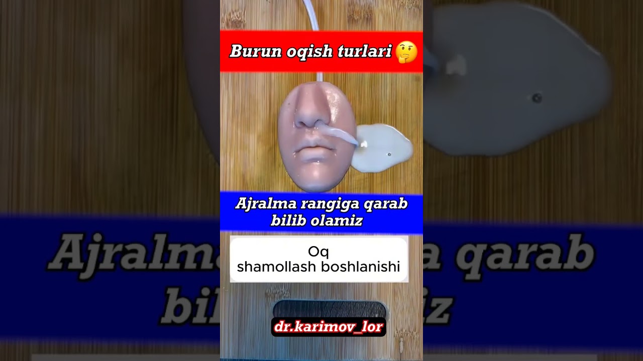 Burun oqish turlari Ajralma ranglari