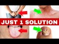 Just 1 Solution To Control infection ,Candida, Leukorrhea, Yeast Over Growth