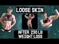 Loose Skin AFTER 230 Pounds of Weight Loss || My Body!