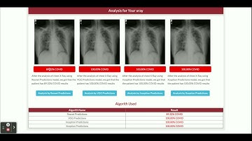 Covid Detection Using X Ray and CT Scan - Python Machine Learning Project