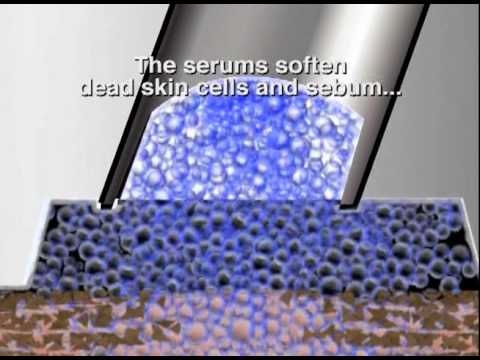 HydraFacial Testimonials