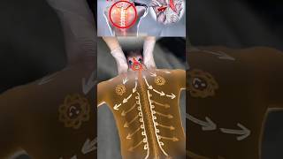 Neck & shoulder back pain relief message #backpain #treatment
